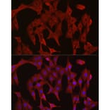 Immunofluorescence - Anti-Caspase-3 Antibody (A81220) - Antibodies.com