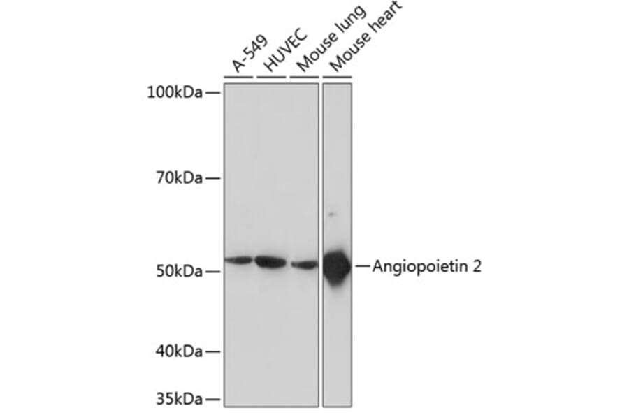Western Blot - Anti-Angiopoietin 2/ANG2 Antibody [ARC0571] (A81221) - Antibodies.com