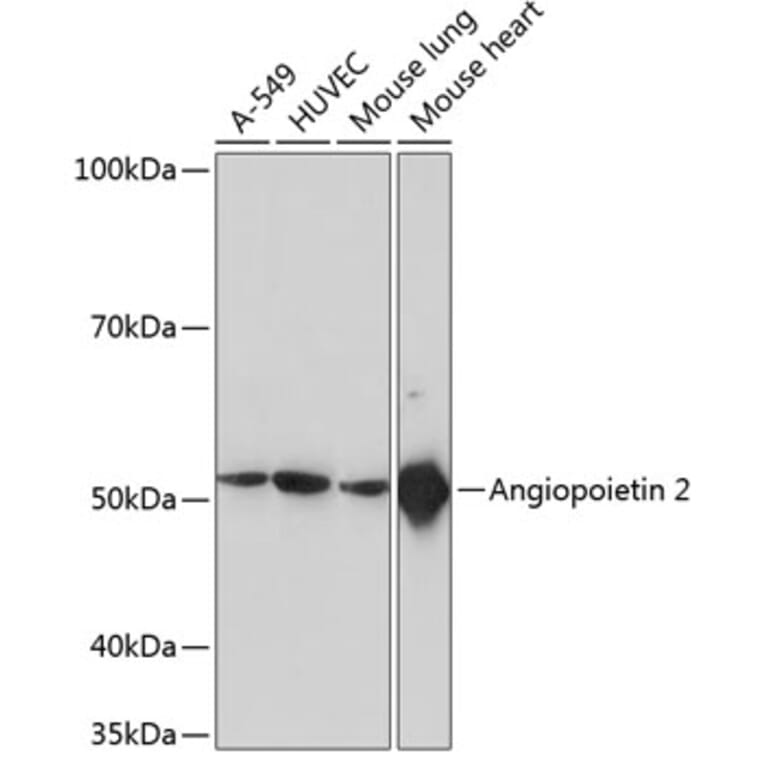 Western Blot - Anti-Angiopoietin 2/ANG2 Antibody [ARC0571] (A81221) - Antibodies.com