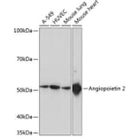 Western Blot - Anti-Angiopoietin 2/ANG2 Antibody [ARC0571] (A81221) - Antibodies.com