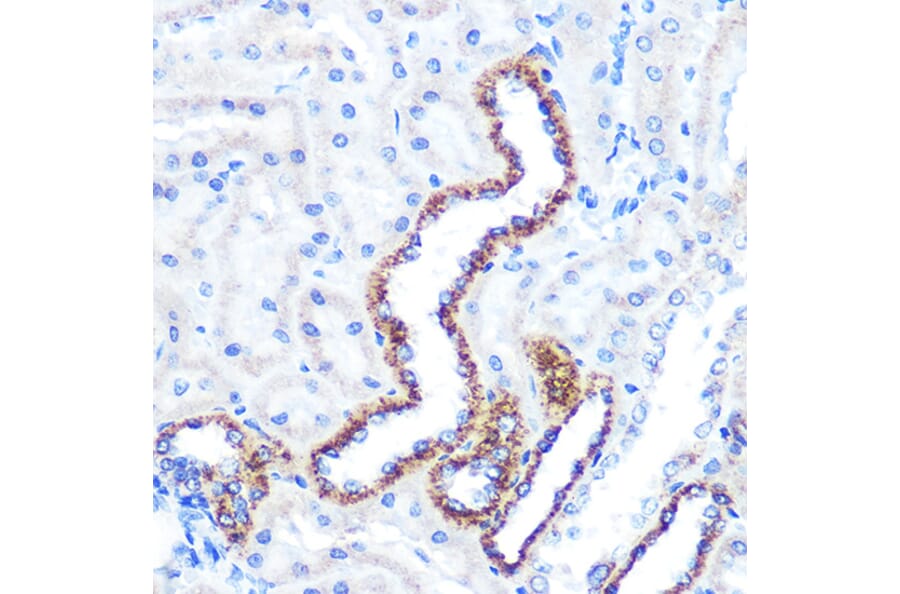 Immunohistochemistry - Anti-Angiopoietin 2/ANG2 Antibody [ARC0571] (A81221) - Antibodies.com