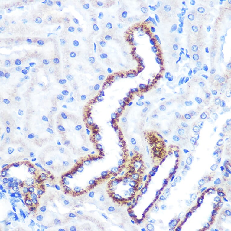 Immunohistochemistry - Anti-Angiopoietin 2/ANG2 Antibody [ARC0571] (A81221) - Antibodies.com