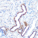 Immunohistochemistry - Anti-Angiopoietin 2/ANG2 Antibody [ARC0571] (A81221) - Antibodies.com