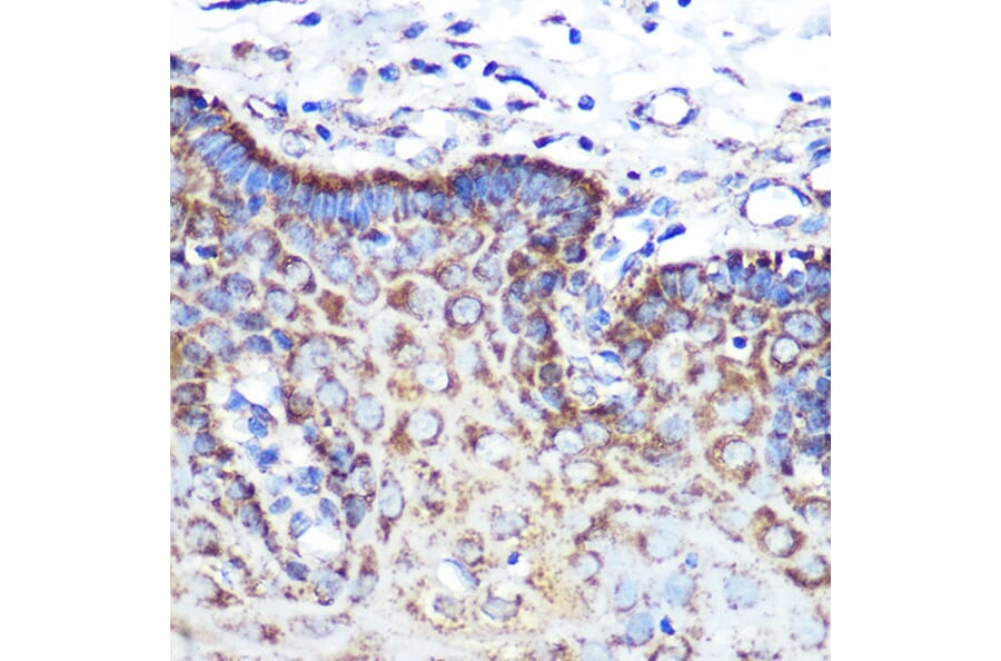 Immunohistochemistry - Anti-Angiopoietin 2/ANG2 Antibody [ARC0571] (A81221) - Antibodies.com
