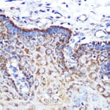Immunohistochemistry - Anti-Angiopoietin 2/ANG2 Antibody [ARC0571] (A81221) - Antibodies.com