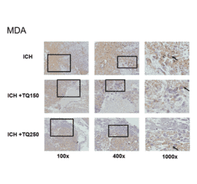 Immunofluorescence - Anti-Malondialdehyde Antibody (A82233) - Antibodies.com Citation