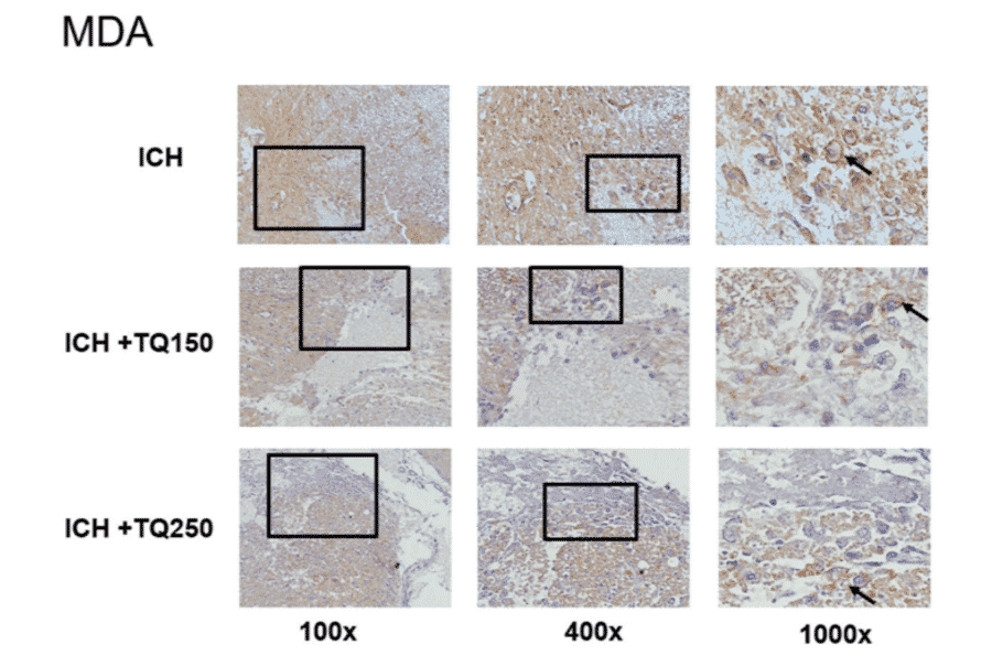 Immunofluorescence - Anti-Malondialdehyde Antibody (A82233) - Antibodies.com Citation