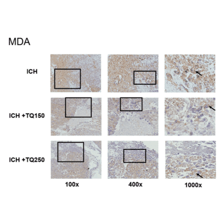 Immunofluorescence - Anti-Malondialdehyde Antibody (A82233) - Antibodies.com Citation