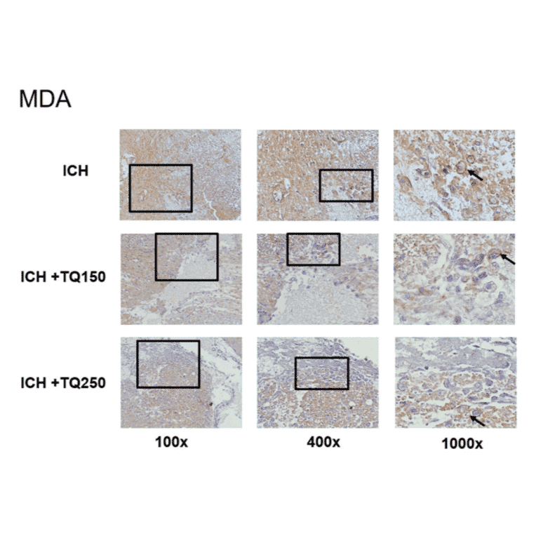 Immunofluorescence - Anti-Malondialdehyde Antibody (A82233) - Antibodies.com Citation