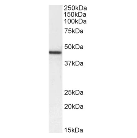 Western Blot - Anti-alpha Smooth Muscle Actin Antibody (A82445) - Antibodies.com