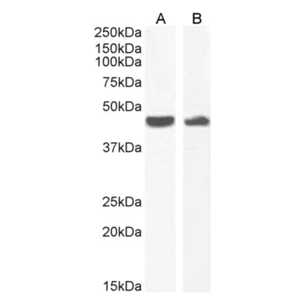 Western Blot - Anti-alpha smooth muscle Actin Antibody (A82445)
