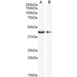 Western Blot - Anti-alpha Smooth Muscle Actin Antibody (A82445) - Antibodies.com