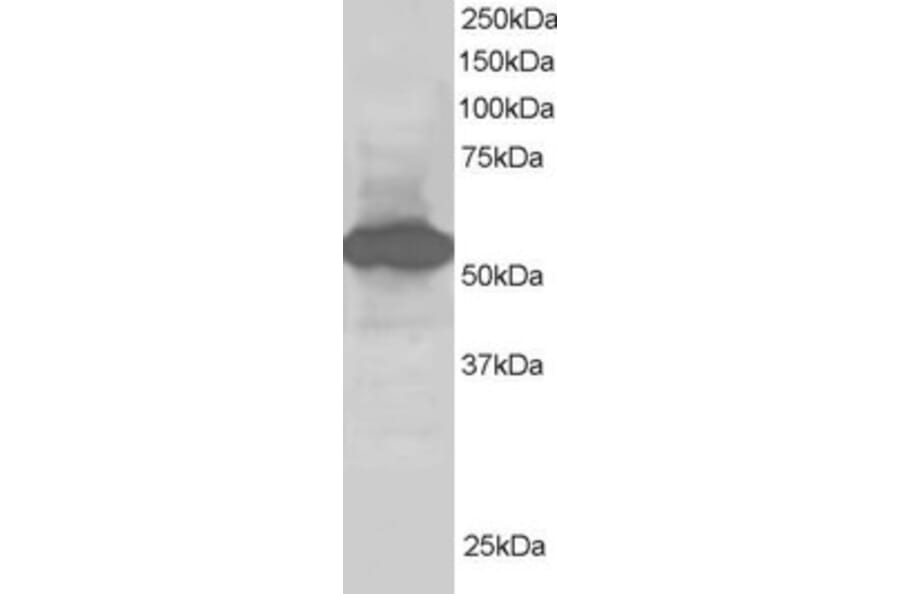 Western Blot - Anti-SIL1 Antibody (A82446) - Antibodies.com