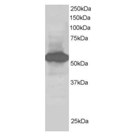 Western Blot - Anti-SIL1 Antibody (A82446) - Antibodies.com