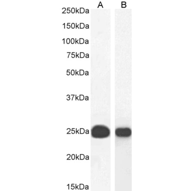 Western Blot - Anti-HP1 alpha Antibody (A82447) - Antibodies.com