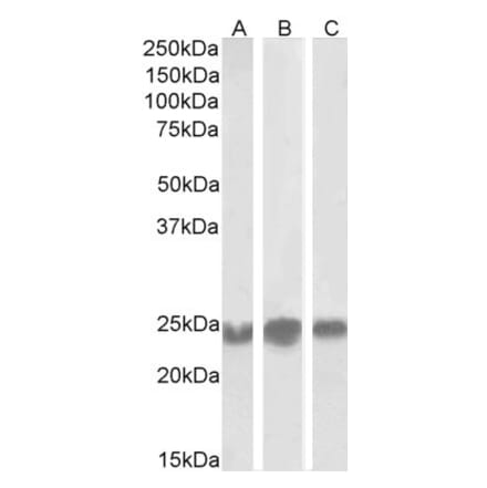 Western Blot - Anti-CBX5 Antibody (A82447) - Antibodies.com