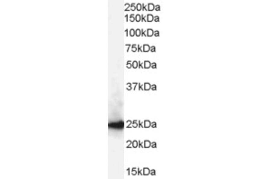 Western Blot - Anti-CBX1/HP1 beta Antibody (A82448) - Antibodies.com