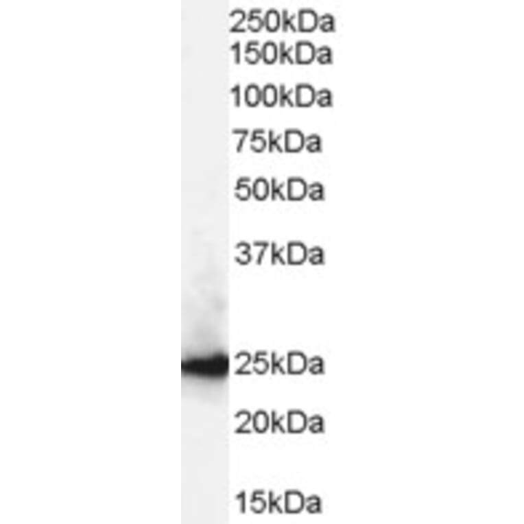 Western Blot - Anti-CBX1/HP1 beta Antibody (A82448) - Antibodies.com