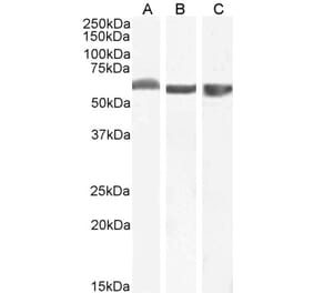 Western Blot - Anti-FTCD Antibody (A82449)