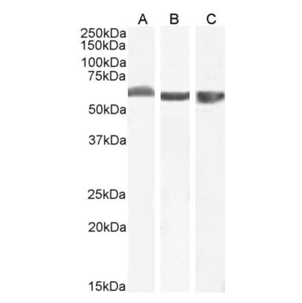 Western Blot - Anti-FTCD Antibody (A82449)