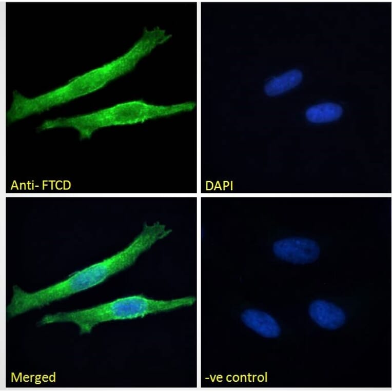 Immunofluorescence - Anti-58K Golgi Protein Antibody (A82449) - Antibodies.com