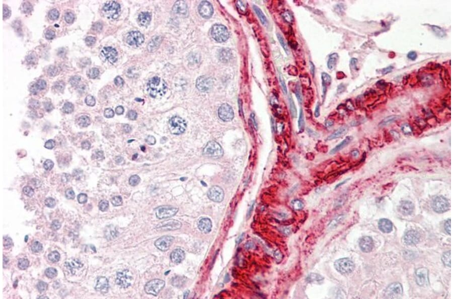 Immunohistochemistry - Anti-Bag5 Antibody (A82450) - Antibodies.com