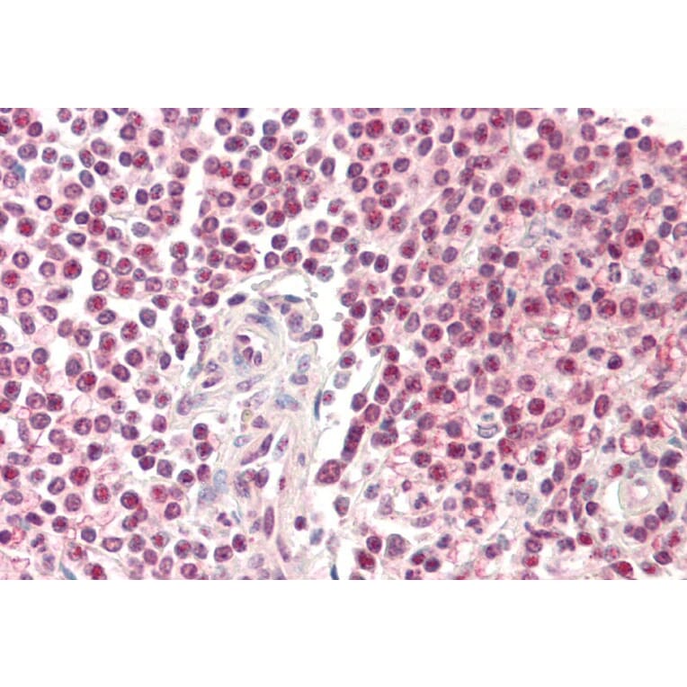 Immunohistochemistry - Anti-Pirin/PIR Antibody (A82451) - Antibodies.com