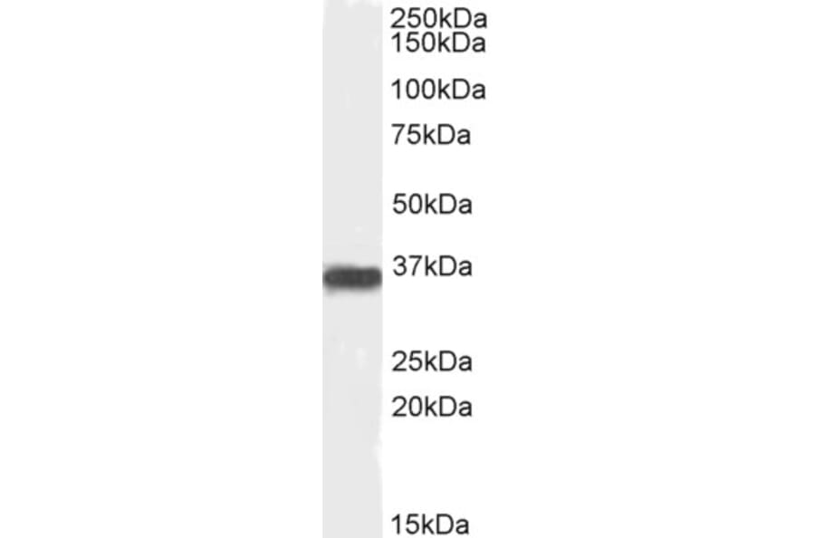 Western Blot - Anti-PP2A alpha + PP2A beta Antibody (A82455) - Antibodies.com