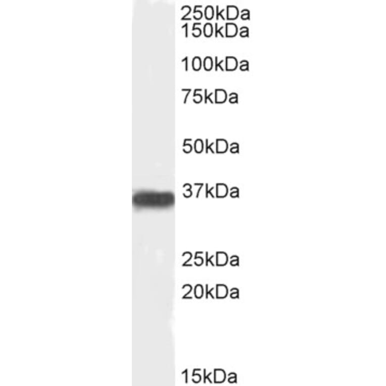 Western Blot - Anti-PP2A alpha + PP2A beta Antibody (A82455) - Antibodies.com