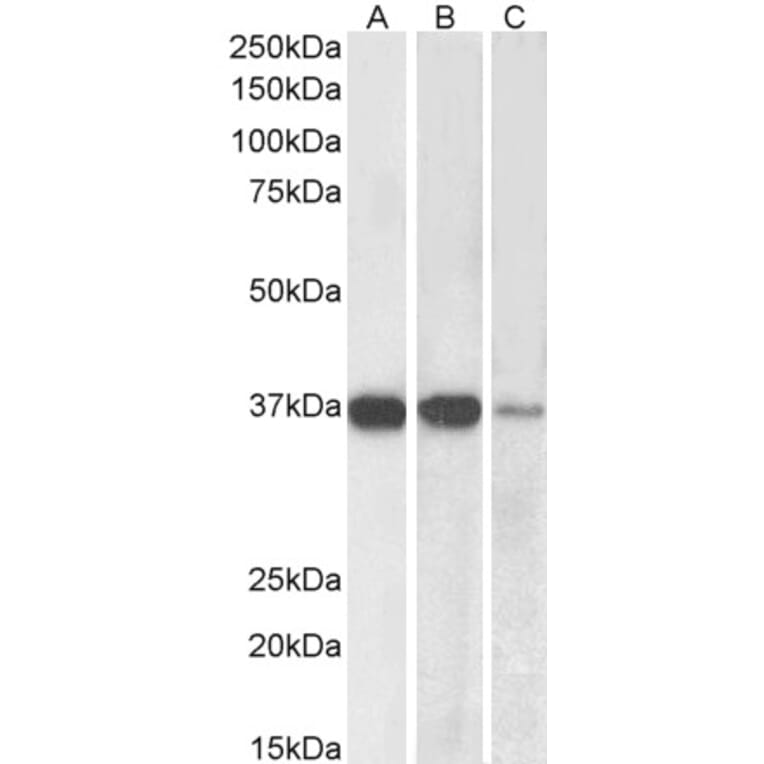 Western Blot - Anti-PP2A alpha + PP2A beta Antibody (A82455) - Antibodies.com