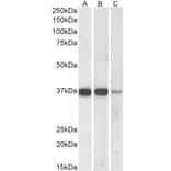 Western Blot - Anti-PP2A alpha + PP2A beta Antibody (A82455) - Antibodies.com