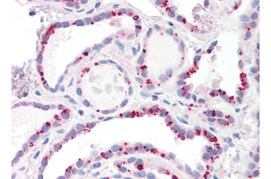 Immunohistochemistry - Anti-PP2A alpha + PP2A beta Antibody (A82455) - Antibodies.com