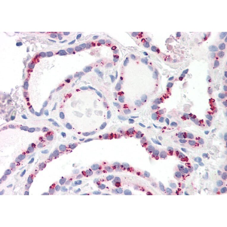 Immunohistochemistry - Anti-PP2A alpha + PP2A beta Antibody (A82455) - Antibodies.com