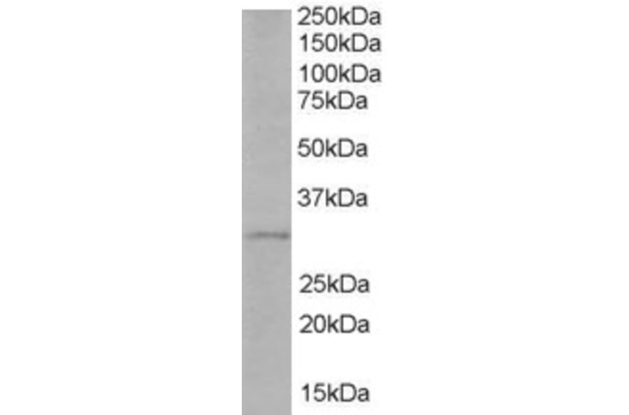 Western Blot - Anti-TIRAP Antibody (A82456) - Antibodies.com