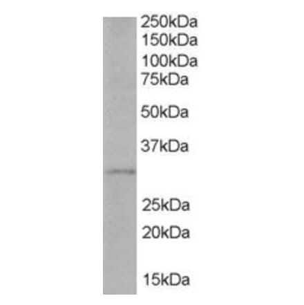 Western Blot - Anti-TIRAP Antibody (A82456) - Antibodies.com