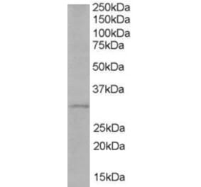 Western Blot - Anti-TIRAP Antibody (A82456) - Antibodies.com