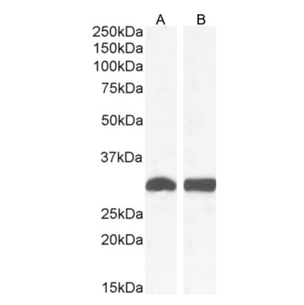 Western Blot - Anti-NQO1 Antibody (A82457) - Antibodies.com