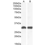 Western Blot - Anti-NQO1 Antibody (A82457) - Antibodies.com