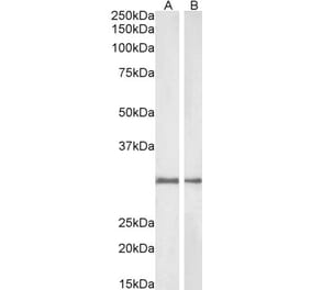 Western Blot - Anti-NQO1 Antibody (A82457) - Antibodies.com