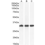 Western Blot - Anti-NQO1 Antibody (A82457) - Antibodies.com