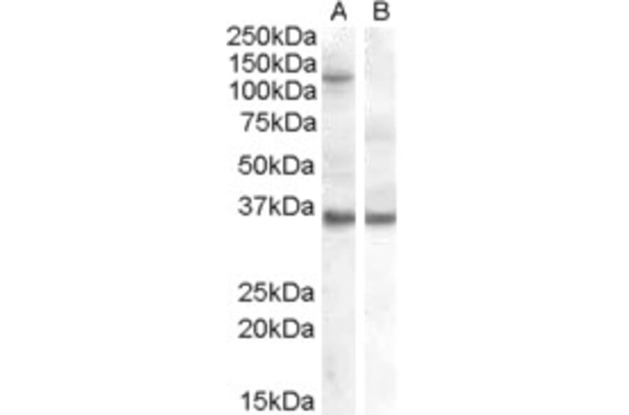 Western Blot - Anti-Ago1 Antibody (A82458) - Antibodies.com