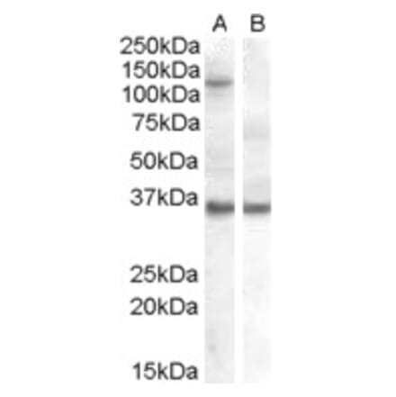 Western Blot - Anti-Ago1 Antibody (A82458) - Antibodies.com