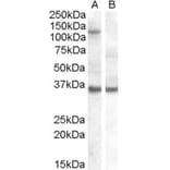 Western Blot - Anti-Ago1 Antibody (A82458) - Antibodies.com