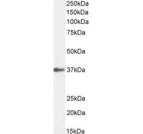 Western Blot - Anti-SIAH1 Antibody (A82459) - Antibodies.com