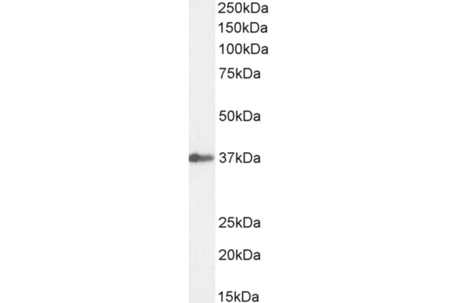 Western Blot - Anti-SIAH1 Antibody (A82459) - Antibodies.com