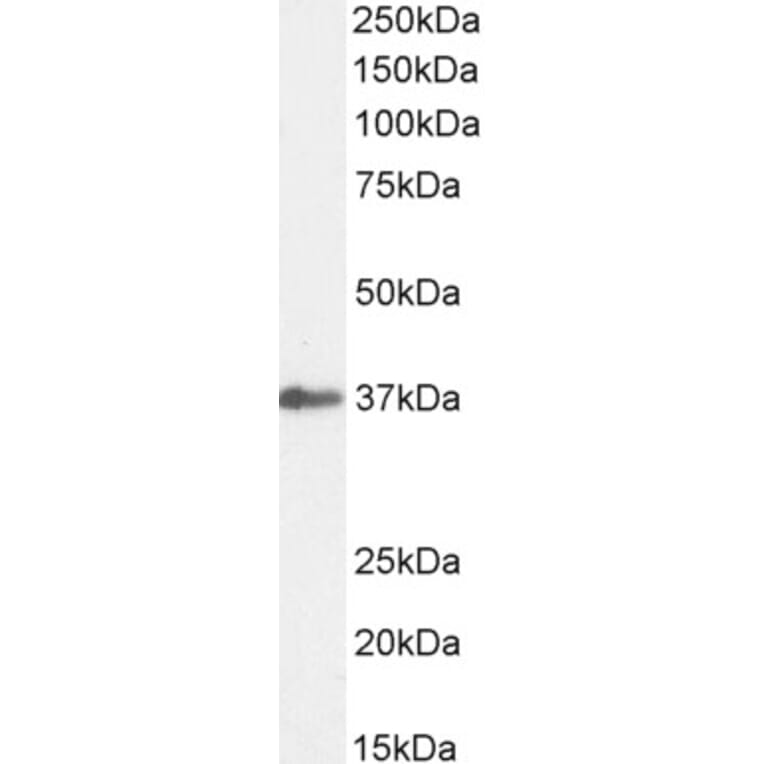 Western Blot - Anti-SIAH1 Antibody (A82459) - Antibodies.com