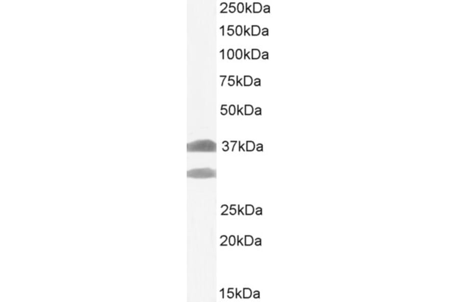Western Blot - Anti-SIAH1 Antibody (A82459) - Antibodies.com