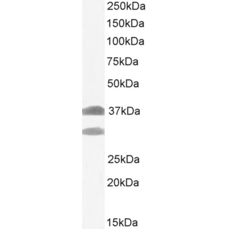 Western Blot - Anti-SIAH1 Antibody (A82459) - Antibodies.com