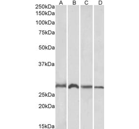 Western Blot - Anti-SIAH1 Antibody (A82459) - Antibodies.com