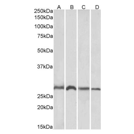 Western Blot - Anti-SIAH1 Antibody (A82459) - Antibodies.com